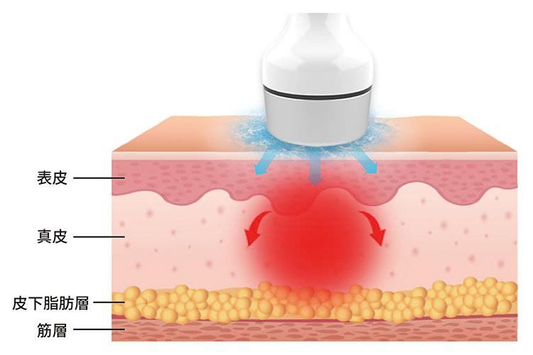 マイクロ波とは